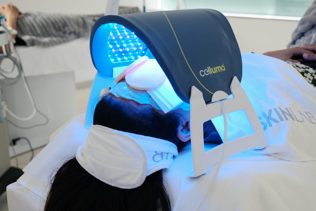 Acne-LED-and-Plasma-Therapies