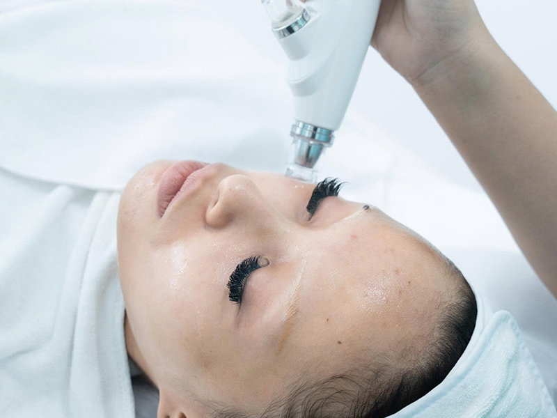 From-Dull-to-Dewy-How-SkinLab-Needl-e-Free-Meso-RF-Transforms-Your-Skin