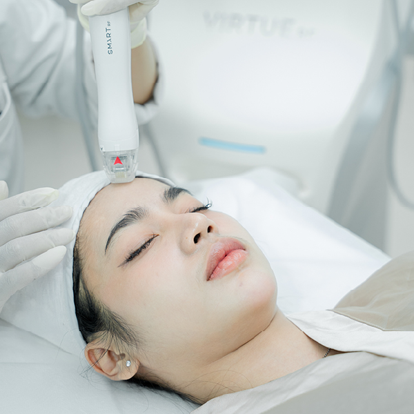 Scar and post-acne mark treatment at SkinLab Cambodia